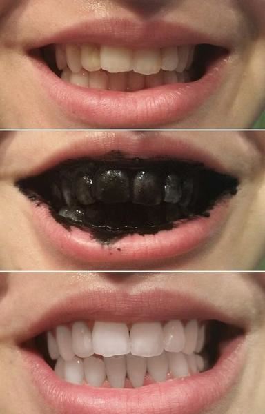 Teeth Whitening black toothpaste with activated charcoal (30 g) - | Fashiongirl